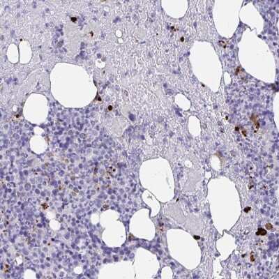 Immunohistochemistry-Paraffin: MLL5 Antibody [NBP2-33775]