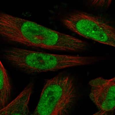 Immunocytochemistry/ Immunofluorescence: MLLT1 Antibody [NBP1-84840]