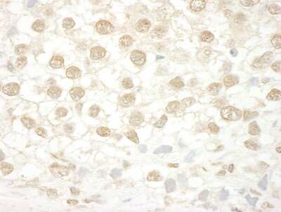 Immunohistochemistry-Paraffin: MLLT1 Antibody [NBP1-26653]