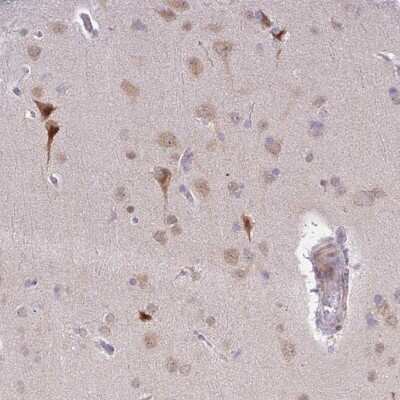 Immunohistochemistry-Paraffin: MLLT11 Antibody [NBP2-14237]