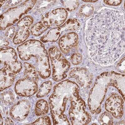 Immunohistochemistry-Paraffin: MLLT11 Antibody [NBP2-14237]