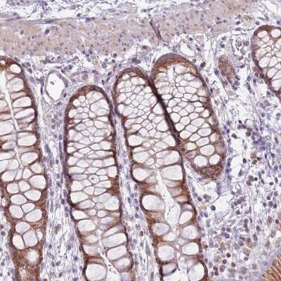 Immunohistochemistry-Paraffin: MLLT11 Antibody [NBP2-14237]