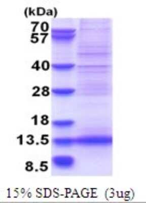 SDS-PAGE: Recombinant Human MLLT11 His Protein [NBP2-51733]