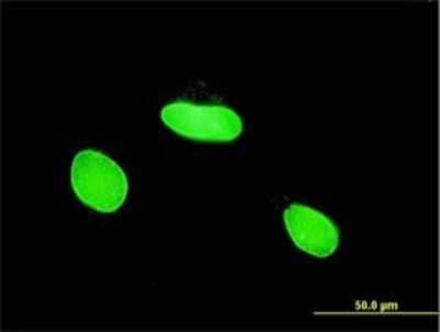 Immunocytochemistry/ Immunofluorescence: MLLT6 Antibody (1B2) [H00004302-M02]