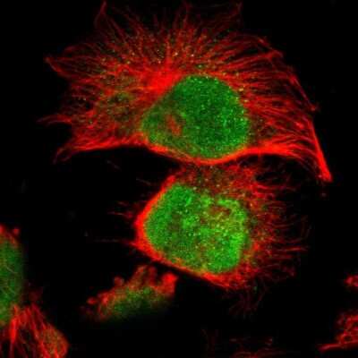 Immunocytochemistry/ Immunofluorescence: MLLT6 Antibody [NBP1-89222]