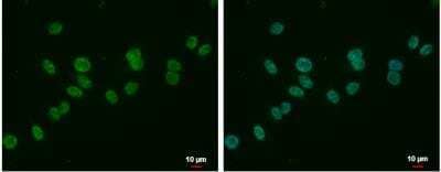 Immunocytochemistry/ Immunofluorescence: MLLT6 Antibody [NBP2-17307]