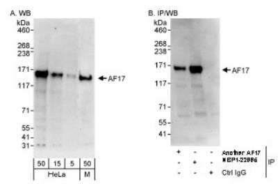 Western Blot: MLLT6 Antibody [NBP1-22995]