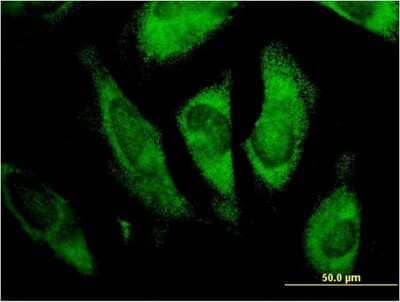 Immunocytochemistry/ Immunofluorescence: MLX Antibody (1C3) [H00006945-M07]