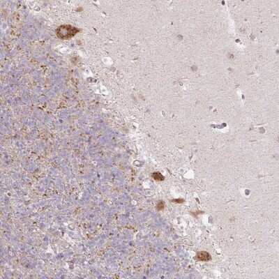 Immunohistochemistry: MLX Antibody [NBP2-37937]