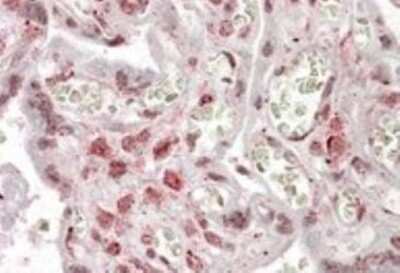 Immunohistochemistry-Paraffin: MLX Antibody [NBP1-46146]