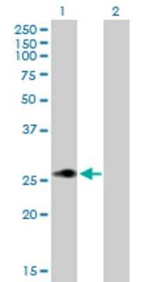 Western Blot: MLX Antibody [H00006945-B02P]