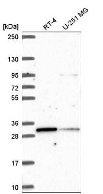 Western Blot: MLX Antibody [NBP2-55725]