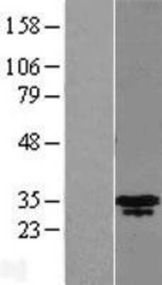 Western Blot: MLX Overexpression Lysate [NBL1-13141]