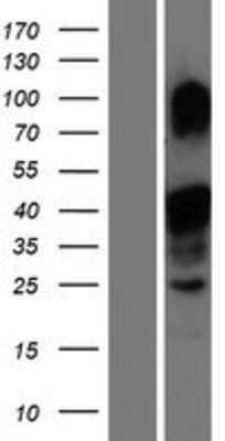 Western Blot: MLX Overexpression Lysate [NBP2-10013]