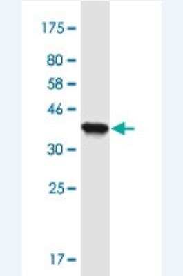 Western Blot: MLXIP Antibody (5F3) [H00022877-M06-100ug]