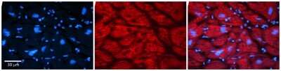 Immunohistochemistry-Paraffin: MLXIP Antibody [NBP2-85298]