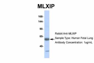 Western Blot: MLXIP Antibody [NBP2-85297]