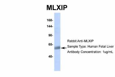 Western Blot: MLXIP Antibody [NBP2-85297]
