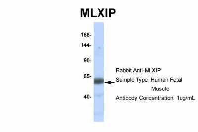 Western Blot: MLXIP Antibody [NBP2-85297]