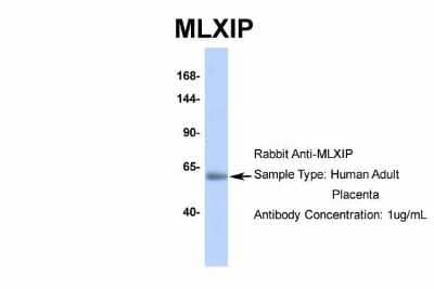 Western Blot: MLXIP Antibody [NBP2-85297]