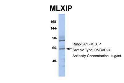 Western Blot: MLXIP Antibody [NBP2-85297]