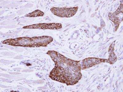 Immunohistochemistry-Paraffin: MLYCD Antibody [NBP1-32797]