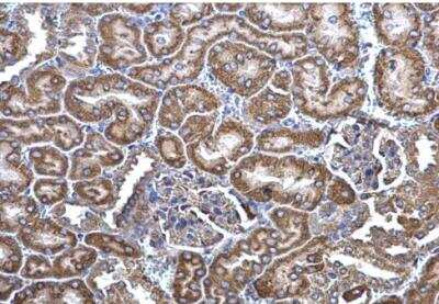 Immunohistochemistry-Paraffin: MLYCD Antibody [NBP1-32797]
