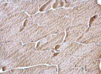 Immunohistochemistry-Paraffin: MLYCD Antibody [NBP1-32797]