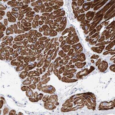 Immunohistochemistry-Paraffin: MLYCD Antibody [NBP1-83247]