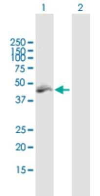 Western Blot: MLYCD Antibody [H00023417-B01P]