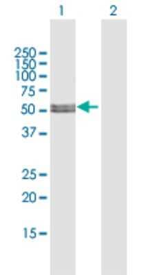 Western Blot: MLYCD Antibody [H00023417-D01P]