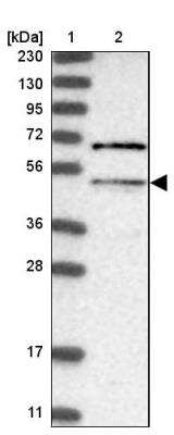 Western Blot: MLYCD Antibody [NBP1-83247]