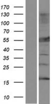 Western Blot: MLYCD Overexpression Lysate [NBP2-07475]