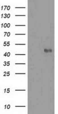 Western Blot: MMAA Antibody (OTI3G5) [NBP2-03496]