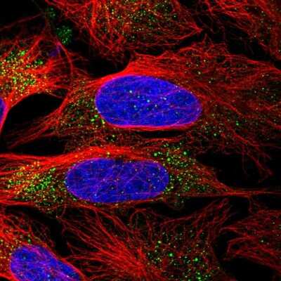 Immunocytochemistry/ Immunofluorescence: MMAA Antibody [NBP1-86603]