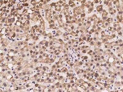 Immunohistochemistry-Paraffin: MMAA Antibody [NBP2-97305]