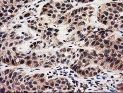Immunohistochemistry: MMAA Antibody (OTI3G5) - Azide and BSA Free [NBP2-72726]