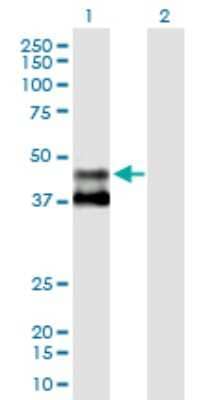 Western Blot: MMAA Antibody [H00166785-B03P]