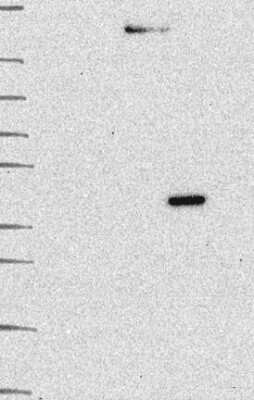 Western Blot: MMAA Antibody [NBP3-17892]