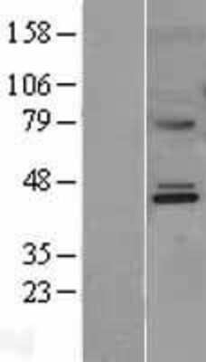 Western Blot: MMAA Overexpression Lysate [NBL1-13142]