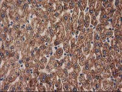 Immunohistochemistry-Paraffin: MMAB Antibody (OTI2G5) [NBP2-03417]