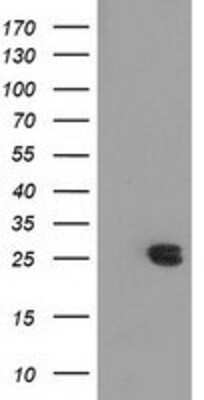 Western Blot: MMAB Antibody (OTI2G5) [NBP2-03417]