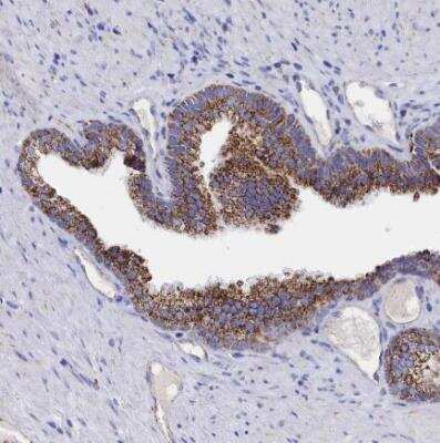 Immunohistochemistry-Paraffin: MMAB Antibody [NBP1-86602]