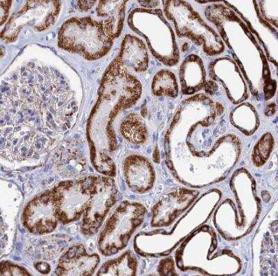 Immunohistochemistry-Paraffin: MMAB Antibody [NBP1-86602]