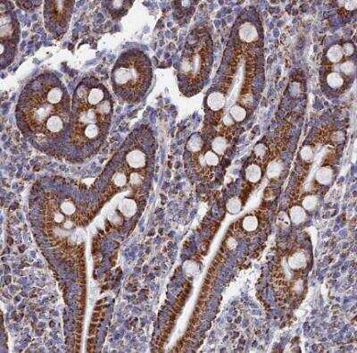 Immunohistochemistry-Paraffin: MMAB Antibody [NBP1-86602]