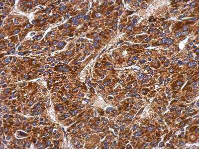 Immunohistochemistry-Paraffin: MMAB Antibody [NBP2-17308]
