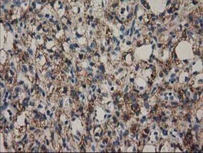 Immunohistochemistry: MMAB Antibody (OTI2G5) - Azide and BSA Free [NBP2-72730]