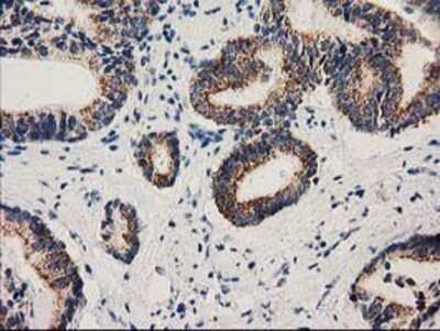 Immunohistochemistry: MMAB Antibody (OTI2G5) - Azide and BSA Free [NBP2-72730]