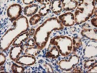 Immunohistochemistry: MMAB Antibody (OTI2G5) - Azide and BSA Free [NBP2-72730]