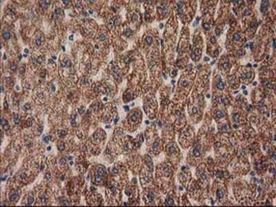 Immunohistochemistry: MMAB Antibody (OTI2G5) - Azide and BSA Free [NBP2-72730]